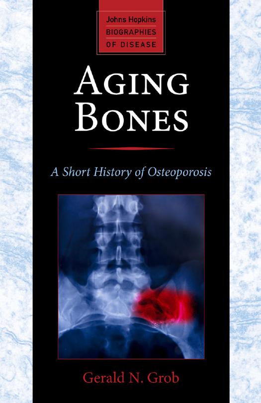Aging Bones: A Short History of Osteoporosis by Gerald N Grob
