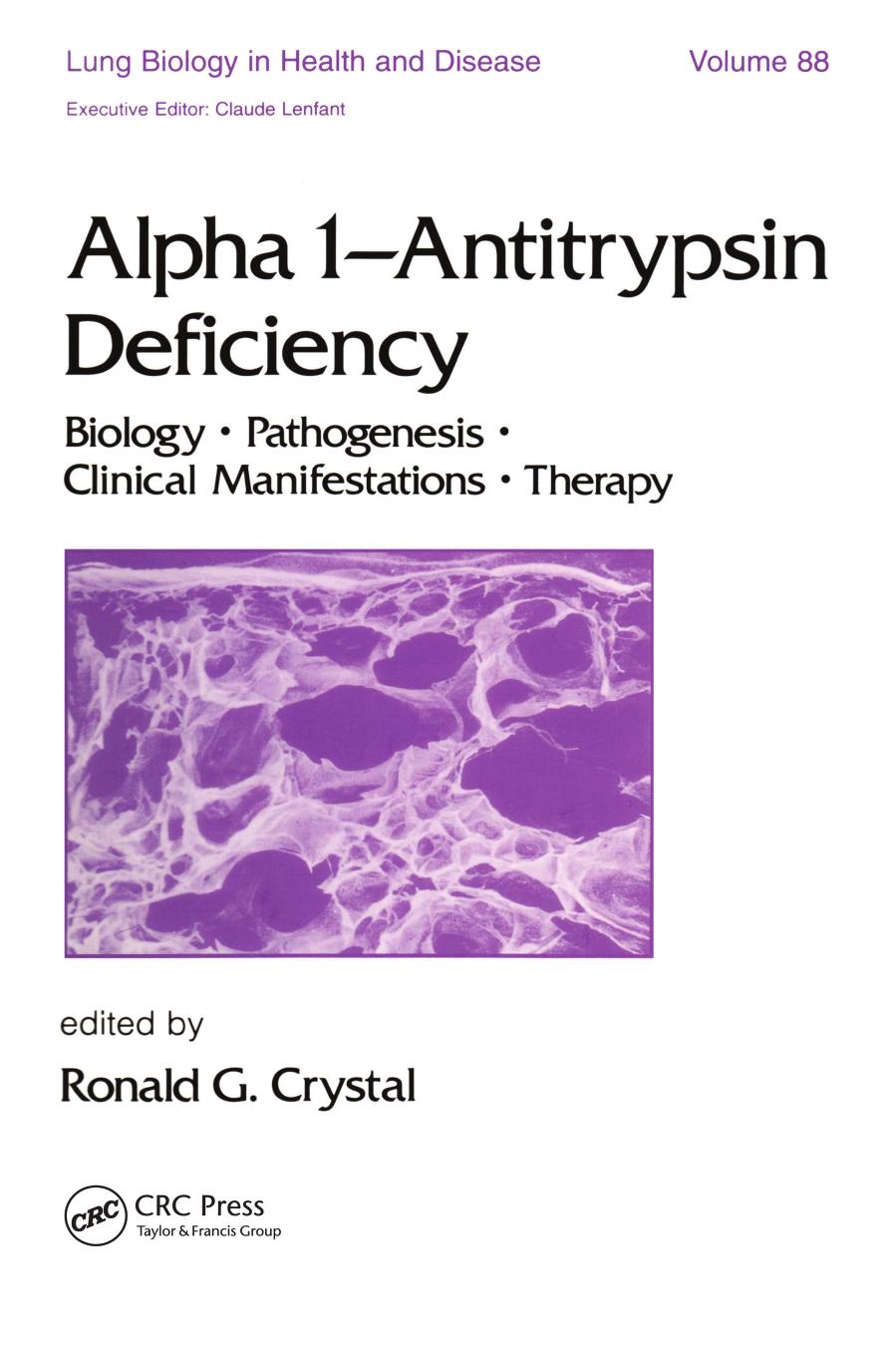 Alpha 1 - Antitrypsin Deficiency: Biology-Pathogenesis-Clinical Manifestations-Therapy by Crystal Ronald G
