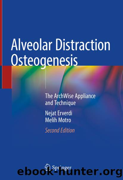 Alveolar Distraction Osteogenesis by Nejat Erverdi & Melih Motro