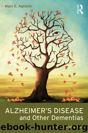 Alzheimer’s Disease and Other Dementias by Marc E. Agronin