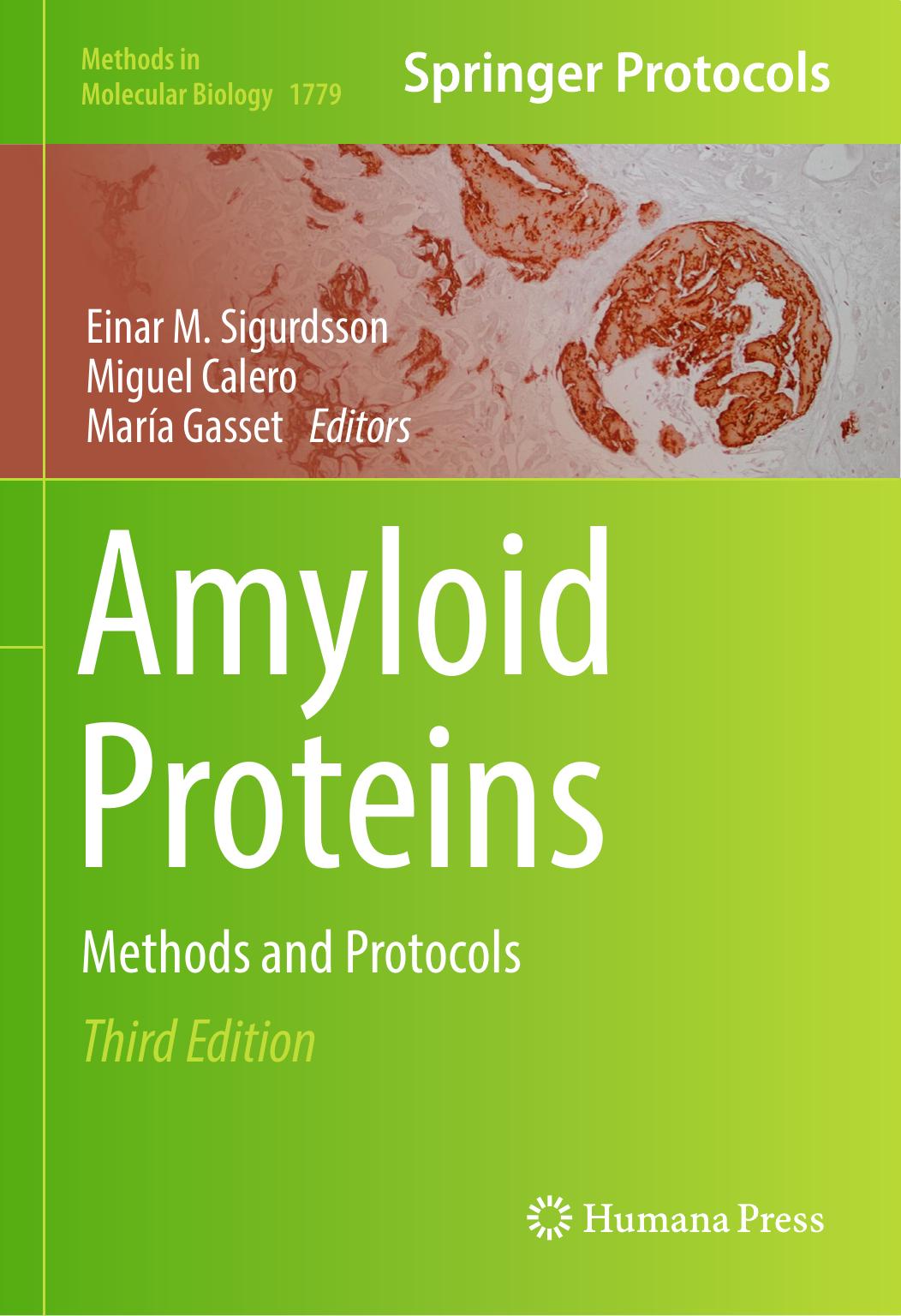 Amyloid Proteins by Einar M. Sigurdsson Miguel Calero María Gasset