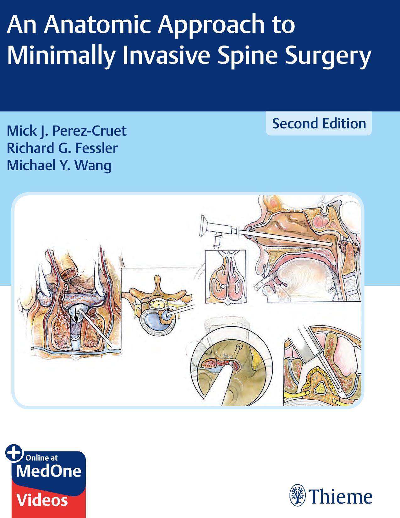 An Anatomic Approach to Minimally Invasive Spine Surgery by Mick J. Perez-Cruet Richard G. Fessler Michael Y. Wang