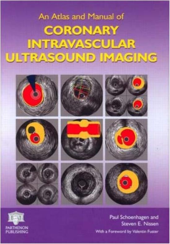 An Atlas and Manual of Coronary Intravascular Ultrasound Imaging by Paul Schoenhagen Steven E. Nissen