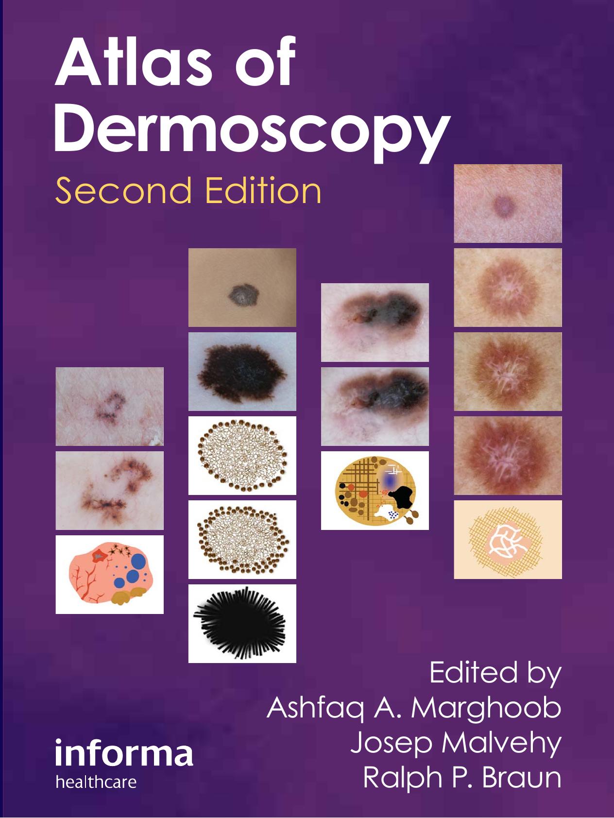 An Atlas of Dermoscopy (2nd edition) (Repost) by Ashfaq A. Marghoob Josep Malvehy Ralph Braun
