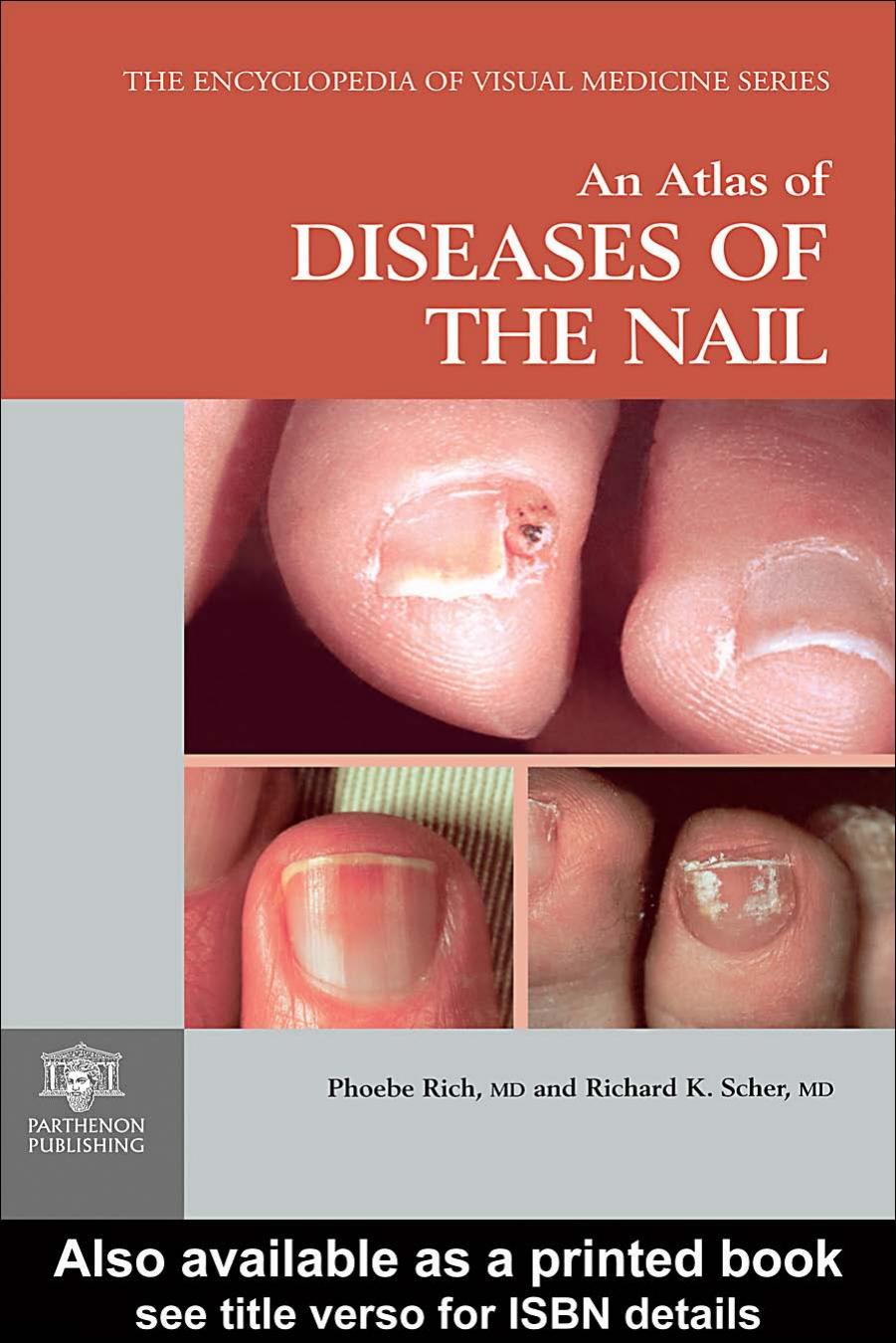 An Atlas of Diseases of the Nail (Encyclopedia of Visual Medicine Series) by Phoebe Rich Richard K. Scher