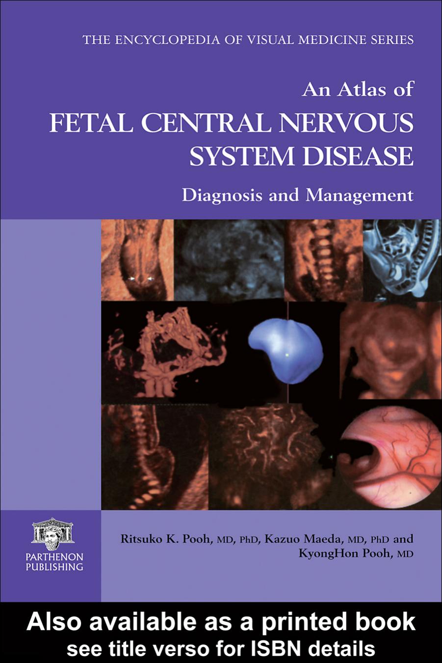 An Atlas of Fetal Central Nervous System Disease: Diagnosis and Management by Ritsuko K. Pooh Kazuo Maeda Kyong Hon Pooh