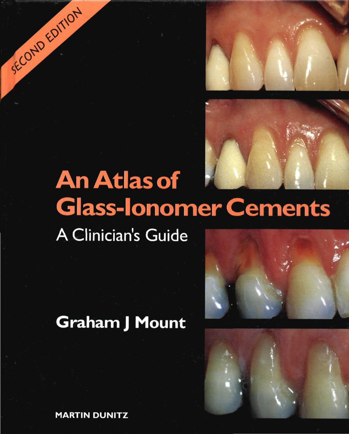 An Atlas of Glass Ionomer Cements by Unknown