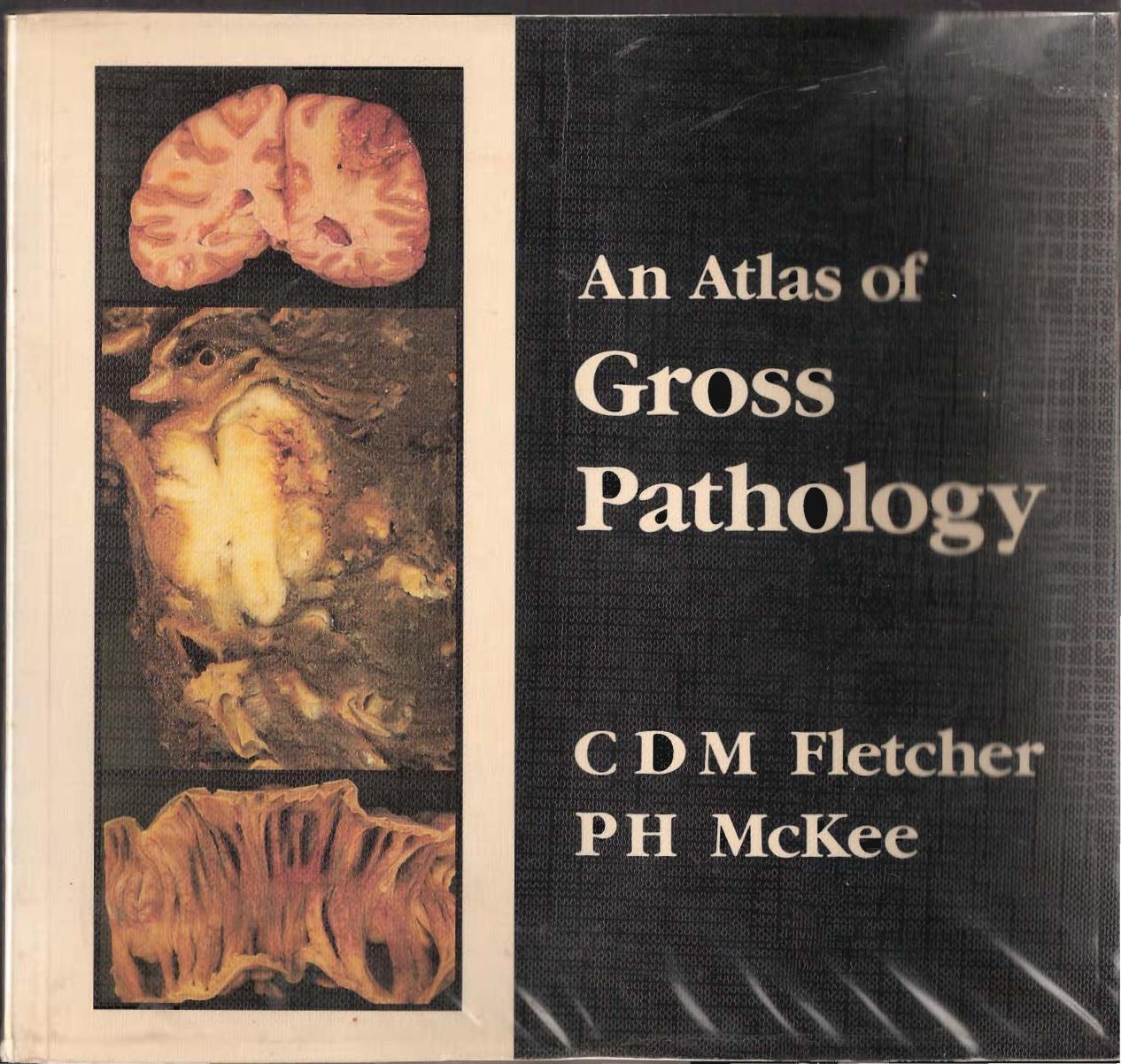 An Atlas of Gross Pathology by Christopher D. M. Fletcher Philip H. McKee