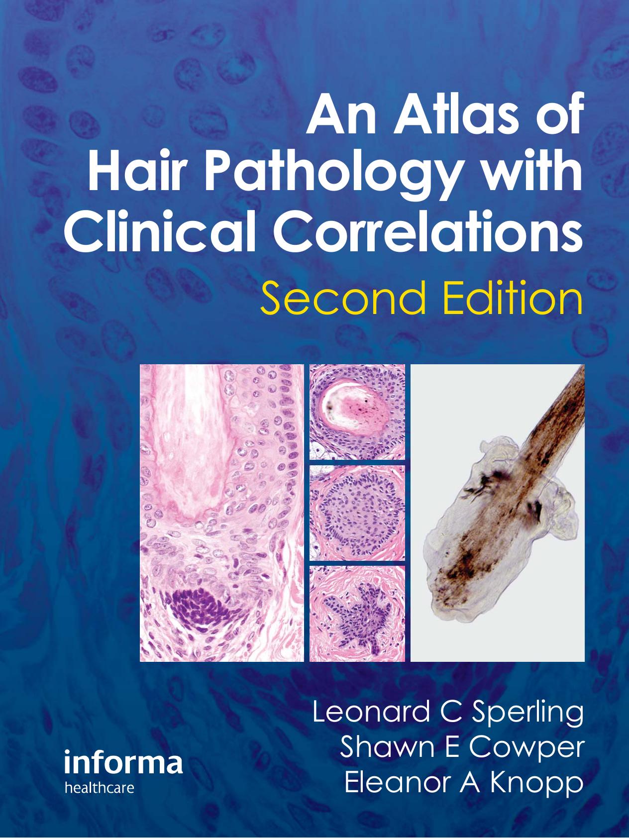 An Atlas of Hair Pathology with Clinical Correlations (Repost) by Unknow