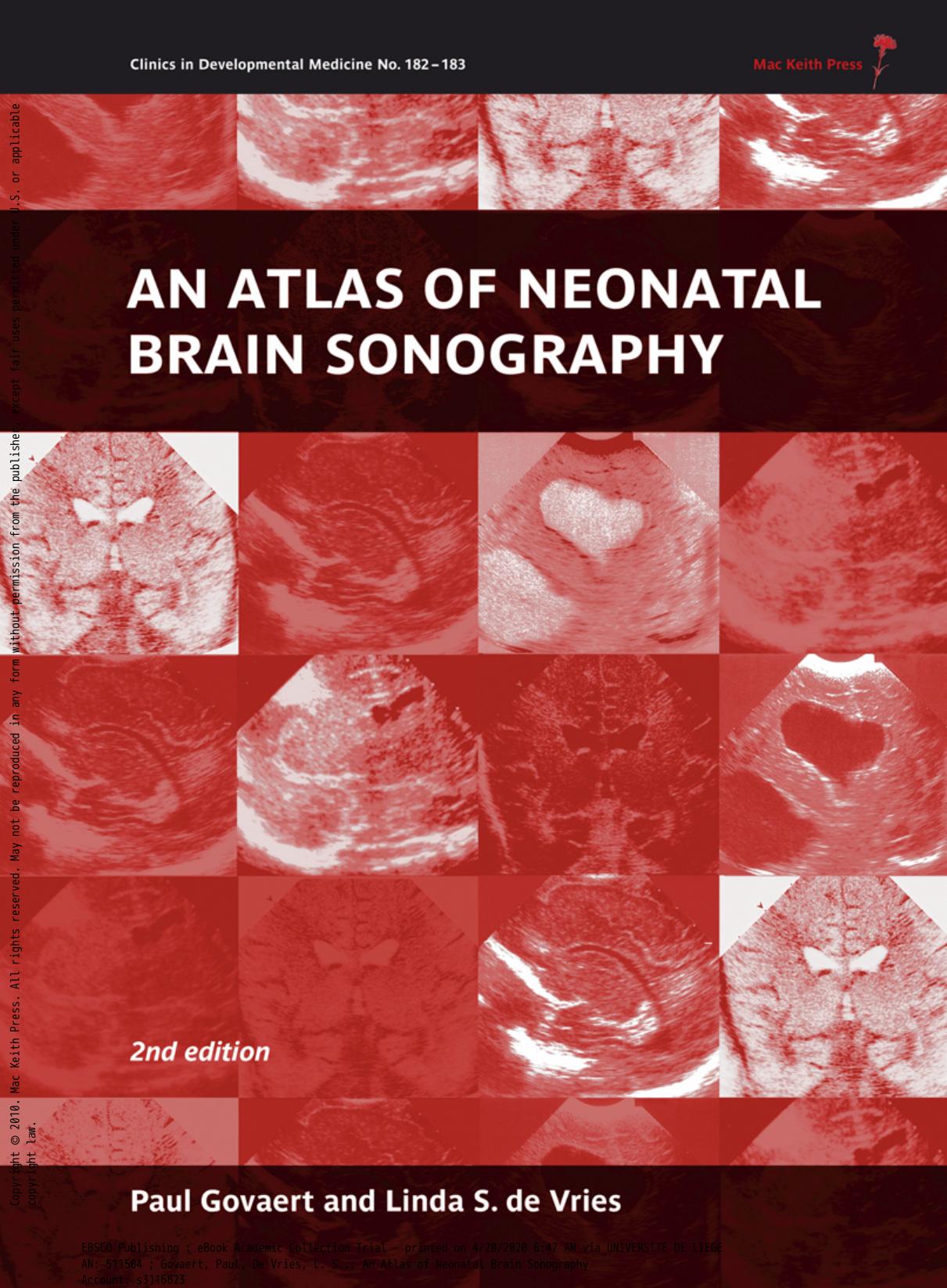 An Atlas of Neonatal Brain Sonography by Paul Govaert Linda S. de Vries