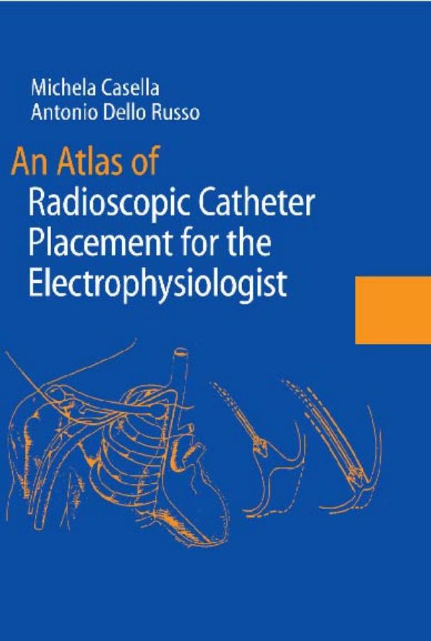 An Atlas of Radioscopic Catheter Placement for the Electrophysiologist by Unknow