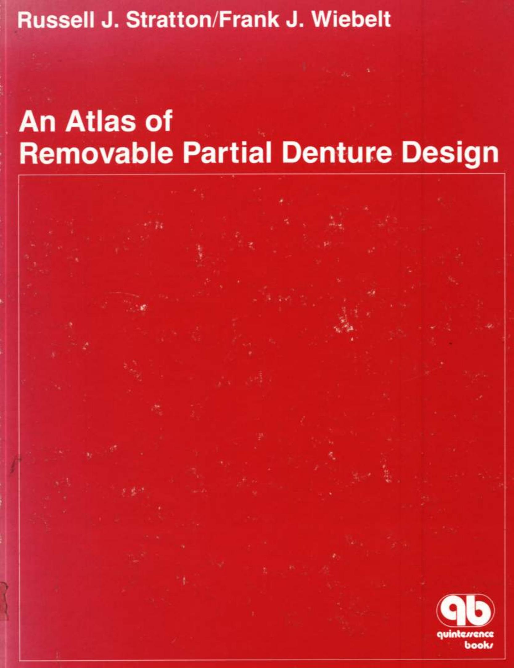 An Atlas of Removable Partial Denture Design by Unknown