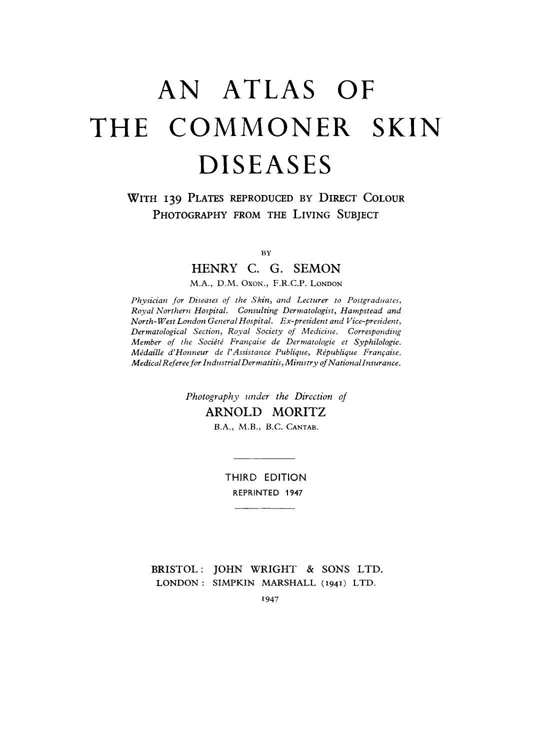An Atlas of the Commoner Skin Diseases. With 139 Plates Reproduced by Direct Colour Photography from the Living Subject by Henry C. G. Semon (Auth.)