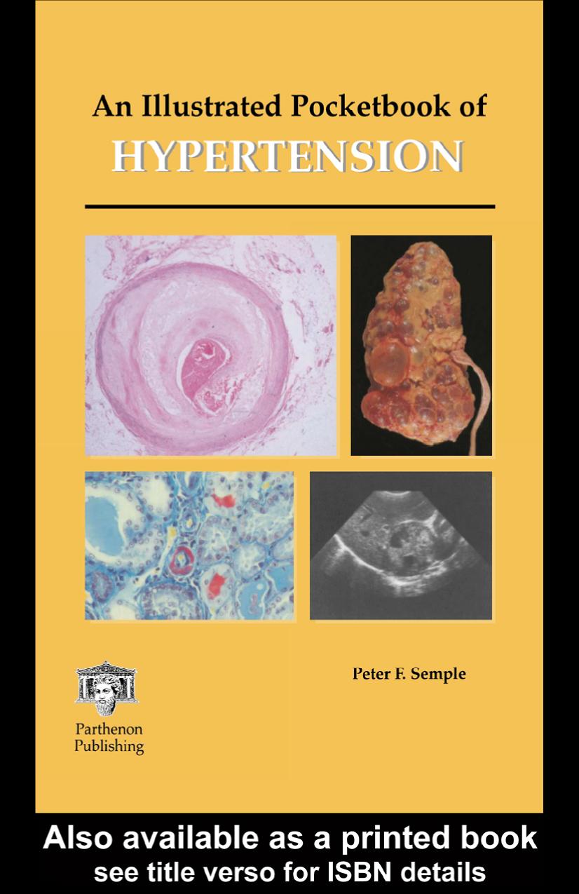 An Illustrated Pocketbook of Hypertension by Peter F. Semple