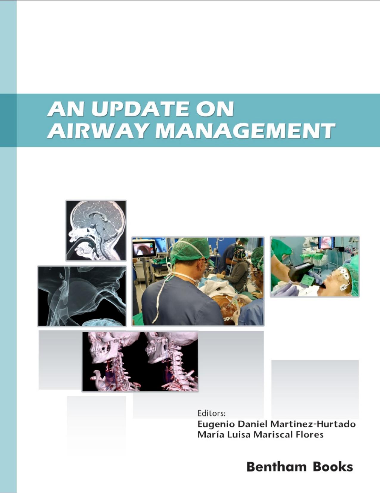 An Update on Airway Management by Eugenio Daniel Martinez-Hurtado; María Luisa Mariscal