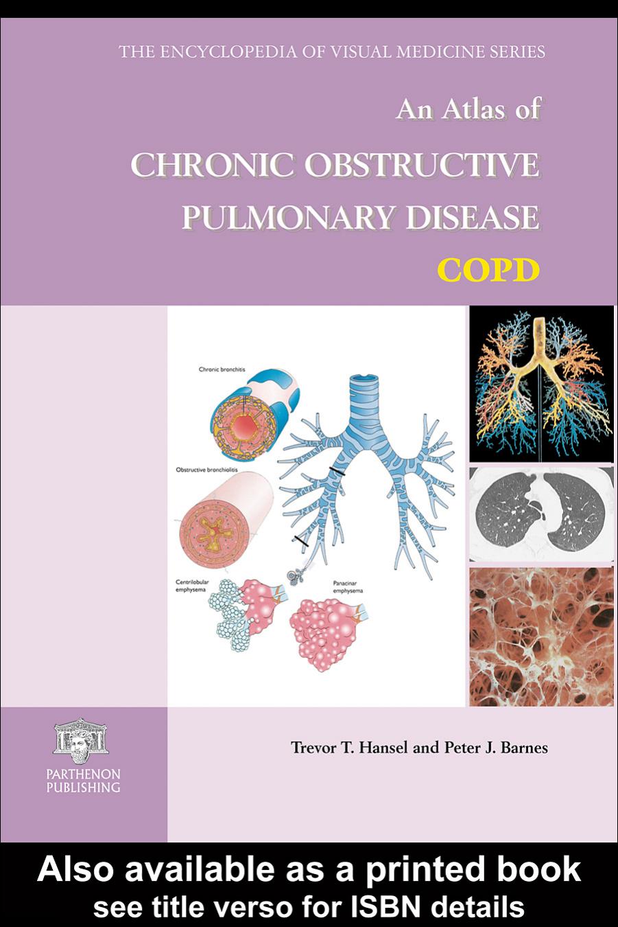 An atlas of chronic obstructive pulmonary disease, COPD by Hansel Trevor T.; Barnes Peter J