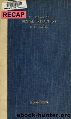 An atlas of dental extractions with notes on the causes and relief of dental pain : designed for the use of medical students and practitioners by Wallis Charles Edward