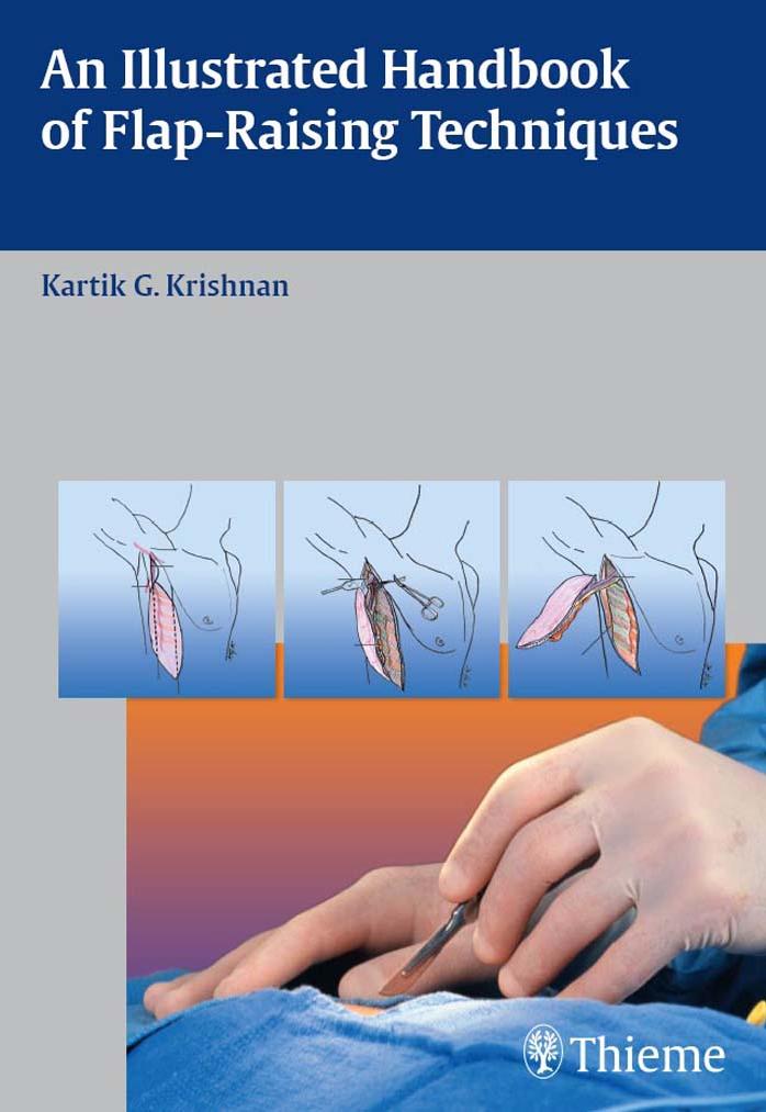 An illustrated handbook of flap-raising techniques by Kartik G. Krishnan
