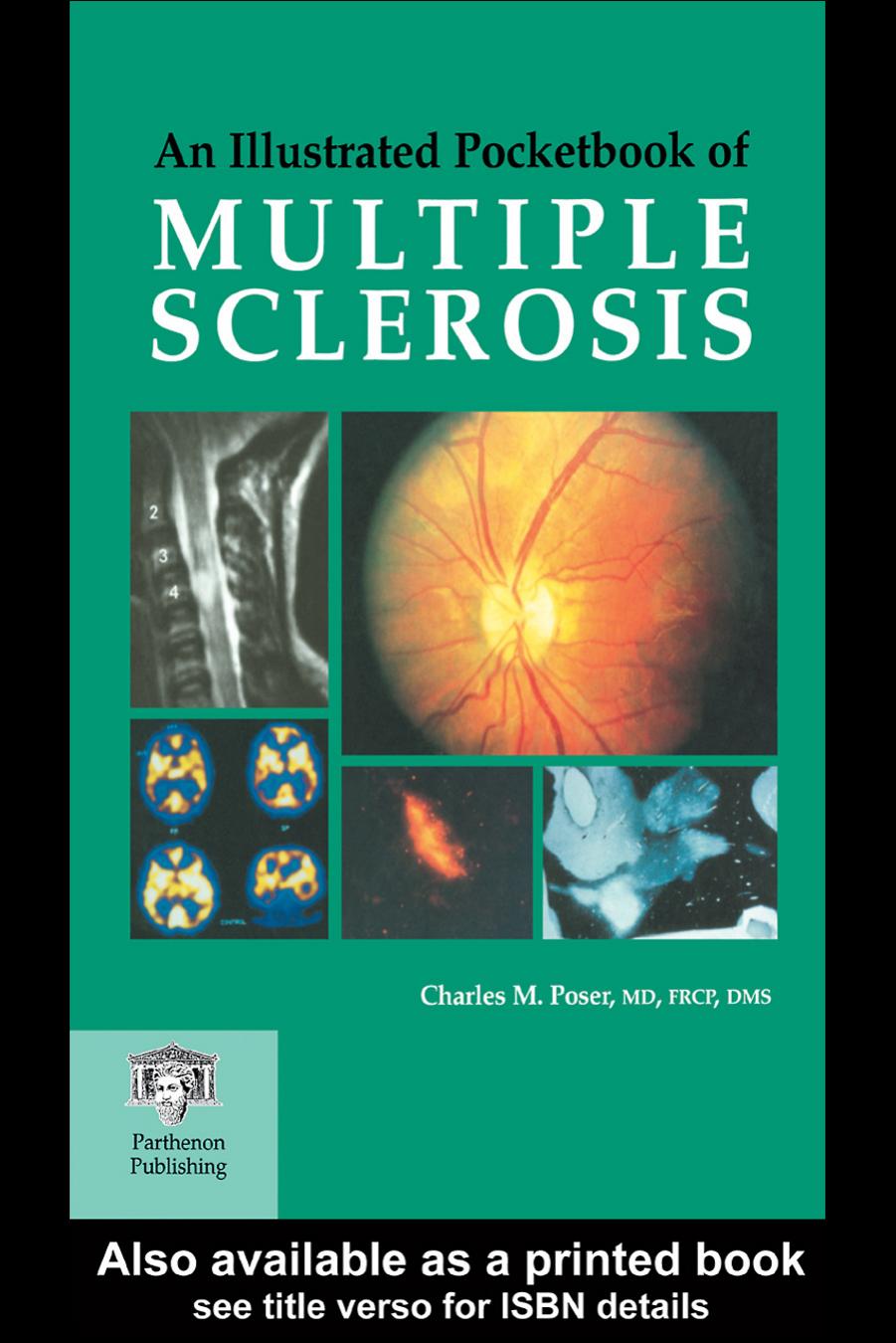 An illustrated pocketbook of multiple sclerosis by Poser Charles M