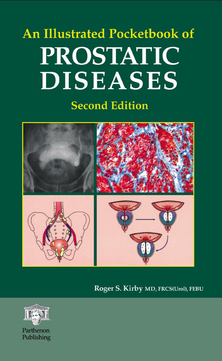 An illustrated pocketbook of prostatic diseases by Kirby Roger S