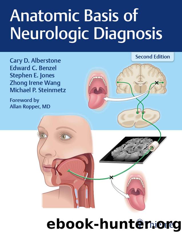 Anatomic Basis of Neurologic Diagnosis by Alberstone Cary D