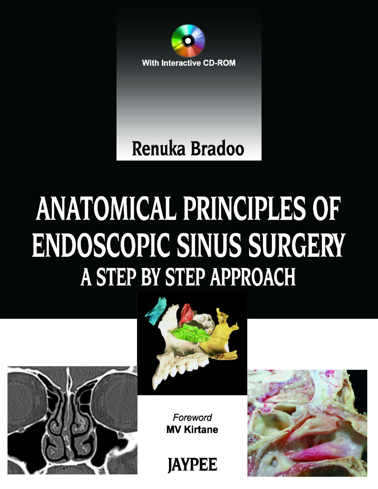 Anatomical principles of endoscopic sinus surgery : a step by step approach. by Renuka Bradoo