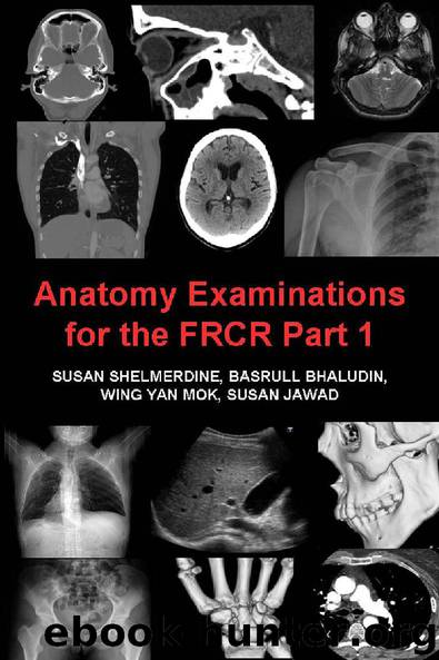 Anatomy Examinations for the FRCR Part 1 by Susan Shelmerdine & Basrull Bhaludin & Wing Yan Mok & Susan Jawad