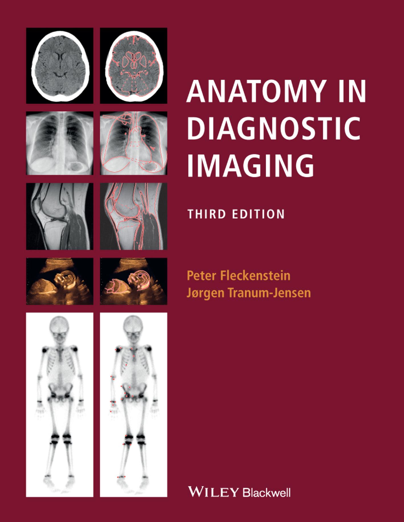 Anatomy in Diagnostic Imaging by Peter Fleckenstein Jørgen Tranum-Jensen