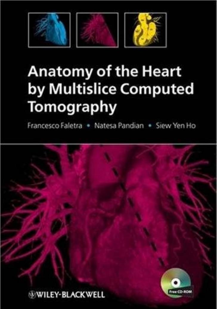 Anatomy of the Heart by Multislice Computed Tomography by Francesco Faletra Natesa Pandian Siew Yen Ho