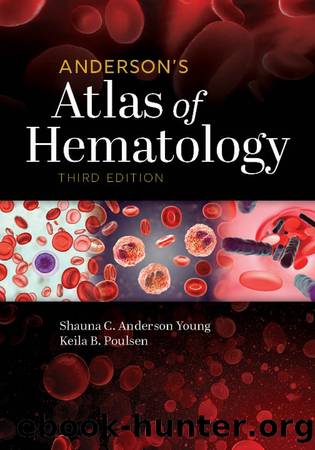 Anderson's Atlas of Hematology by Shauna C. Anderson Young;Keila B. Poulsen; & Keila B. Poulsen