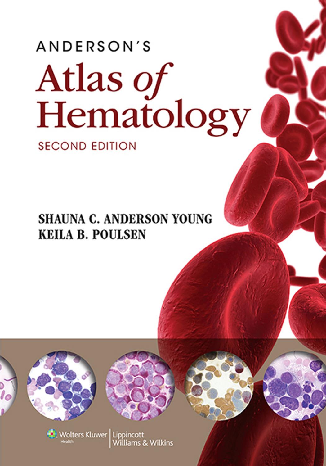 Andersonâs Atlas of Hematology by Shauna C Anderson Young Keila B. Poulsen