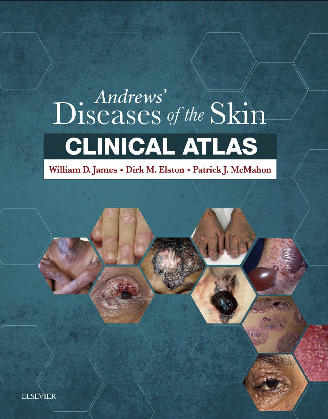 Andrewsâ Diseases of the Skin Clinical Atlas by William James