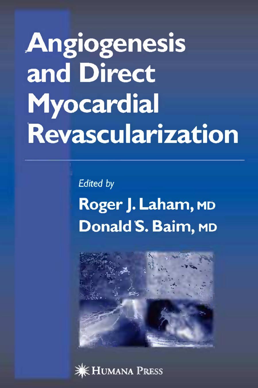 Angiogenesis and Direct Myocardial Revascularization by Roger J. Laham MD (auth.) Roger J. Laham MD Donald S. Baim MD (eds.)