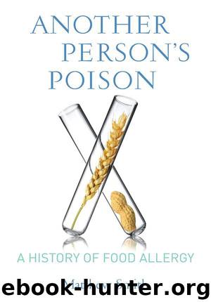 Another Person's Poison: A History of Food Allergy (Arts and Traditions of the Table: Perspe) by Matthew Smith