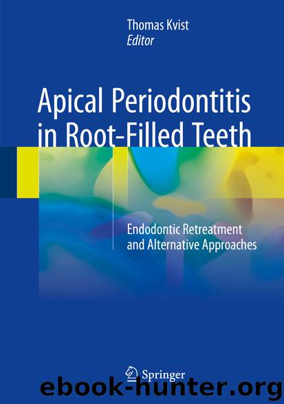 Apical Periodontitis in Root-Filled Teeth by Thomas Kvist