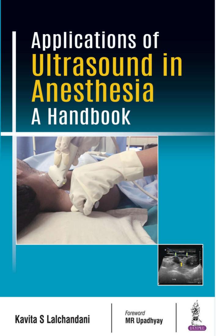 Applications of Ultrasound in Anesthesia A Handbook by Kavita S Lalchandani