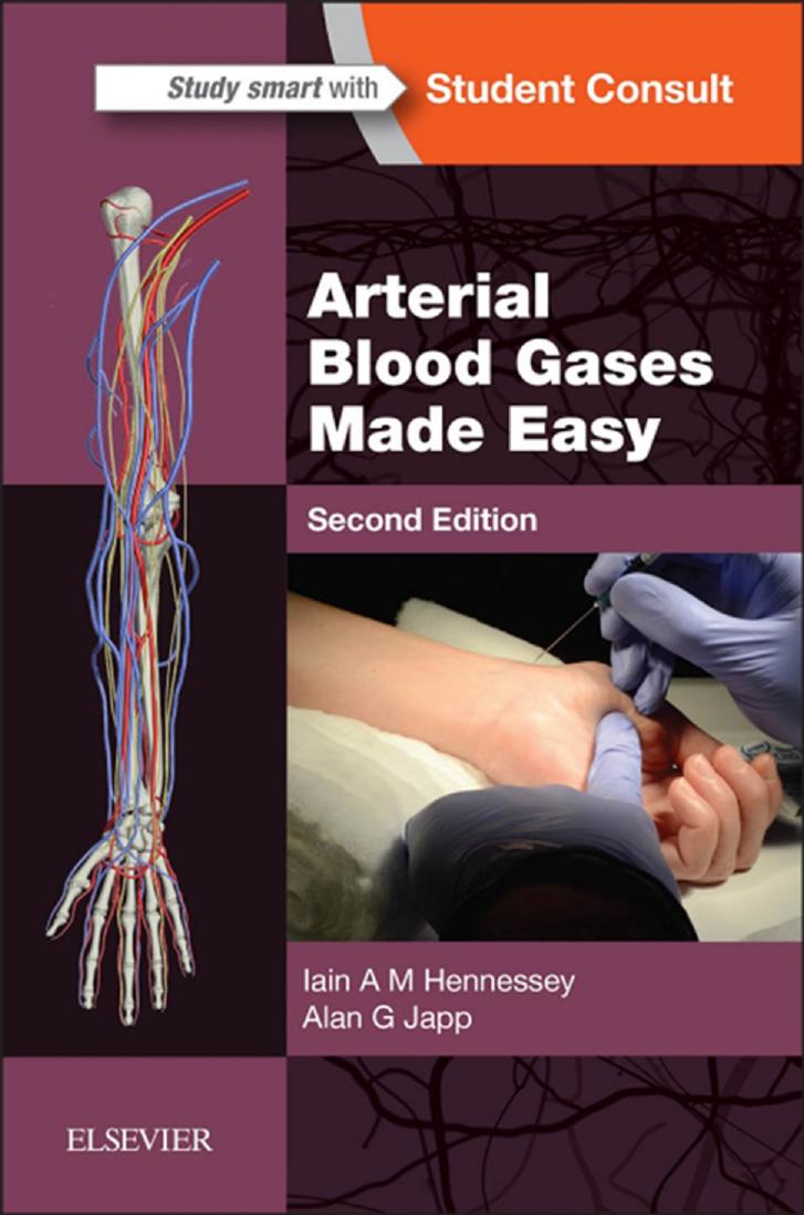 Arterial Blood Gases Made Easy by Iain A. M. Hennessey Alan G. Japp