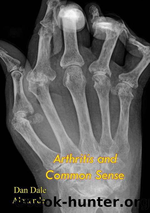 Arthritis and Common Sense by Dan Dale Alexander