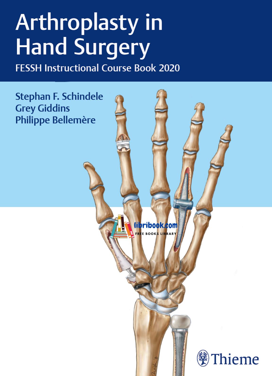 Arthroplasty in Hand Surgery 1st Edition 2021 by Stephan F. Schindele MD Grey Giddins FRCS (Orth) Philippe Bellemère MD