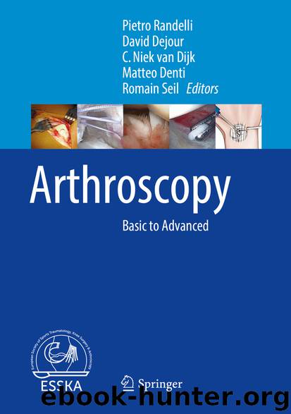 Arthroscopy by Pietro Randelli David Dejour C. Niek van Dijk Matteo Denti & Romain Seil
