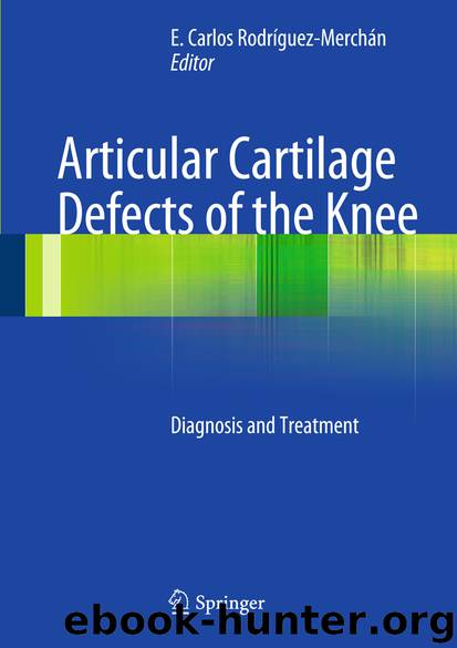 Articular Cartilage Defects of the Knee by E. Carlos Rodrìguez-Merchán