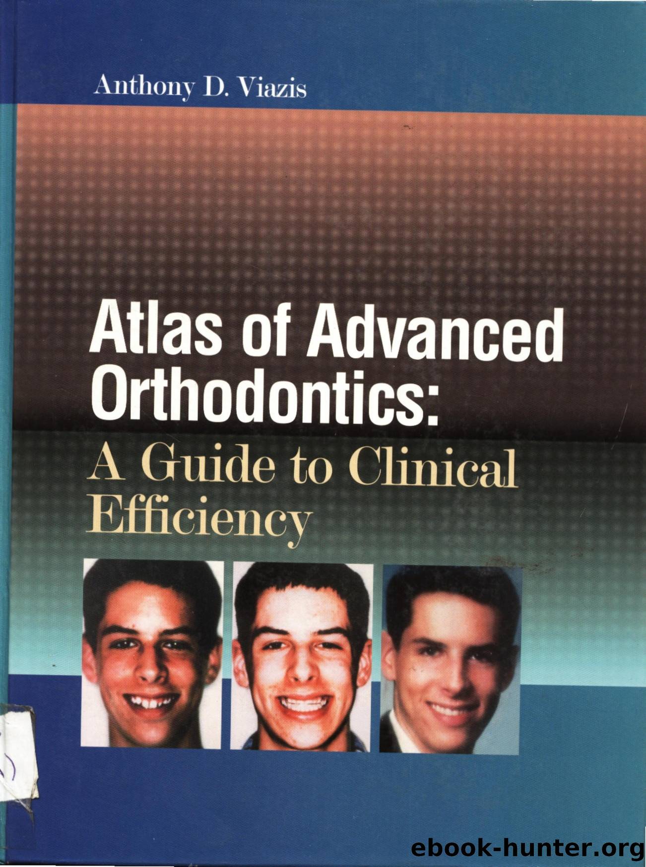 Atlas Of Advanced Orthodontics by Unknown