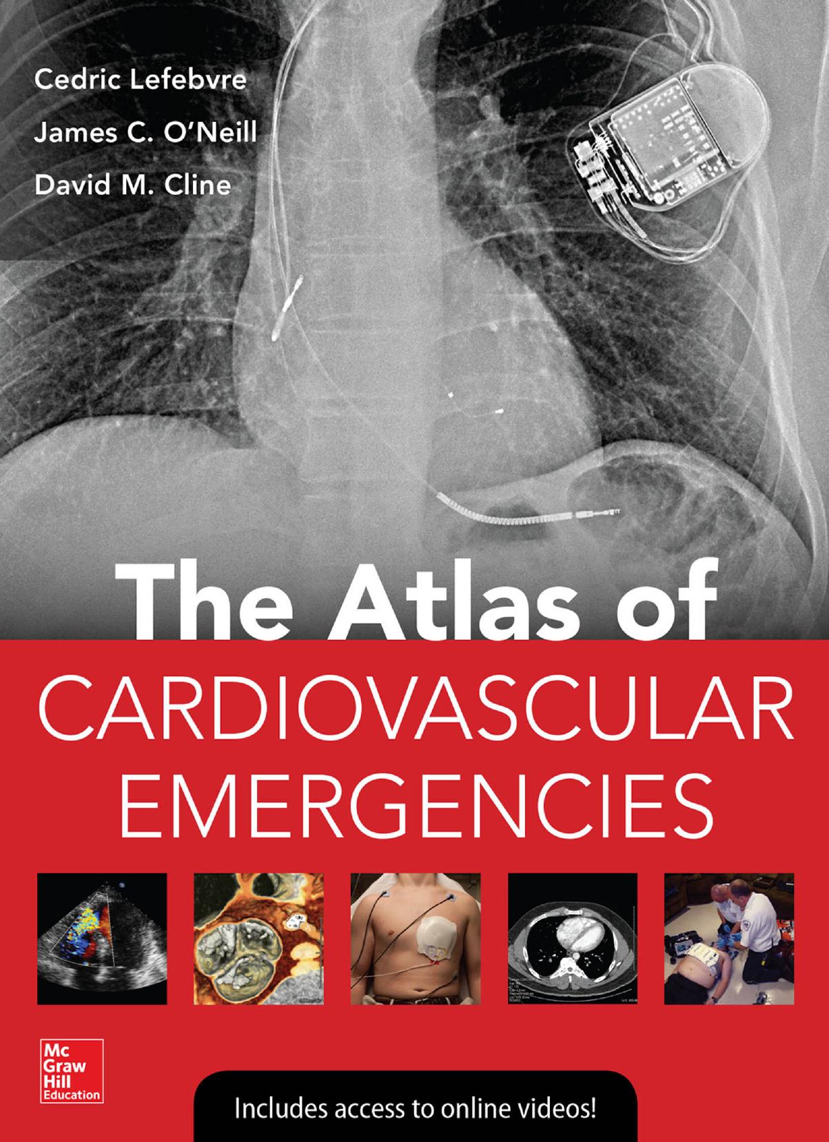 Atlas Of Cardiovascular Emergencies by Cedric Lefebvre James C. O’Neill David M. Cline