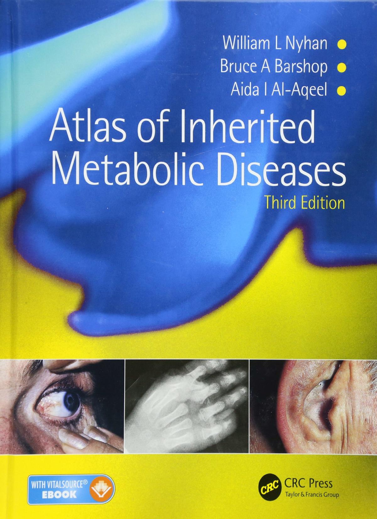 Atlas Of Inherited Metabolic Diseases by William L Nyhan Bruce A Barshop Aida I Al-Aqeel