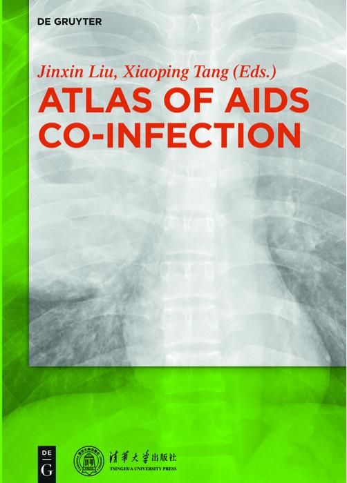 Atlas of AIDS Co-infection by Jinxin Liu Xiaoping Tang