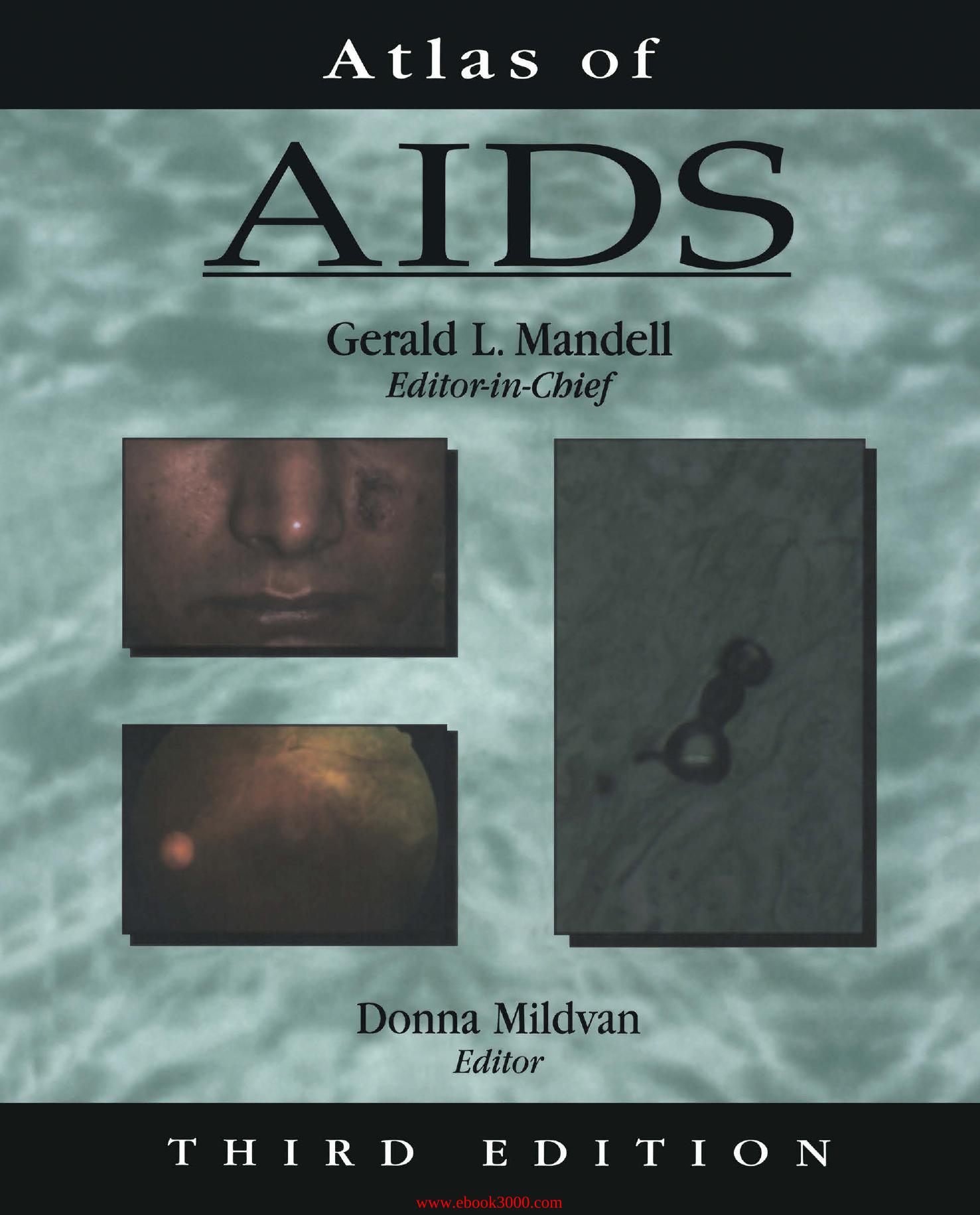 Atlas of AIDS, 3nd Edition by Unknow