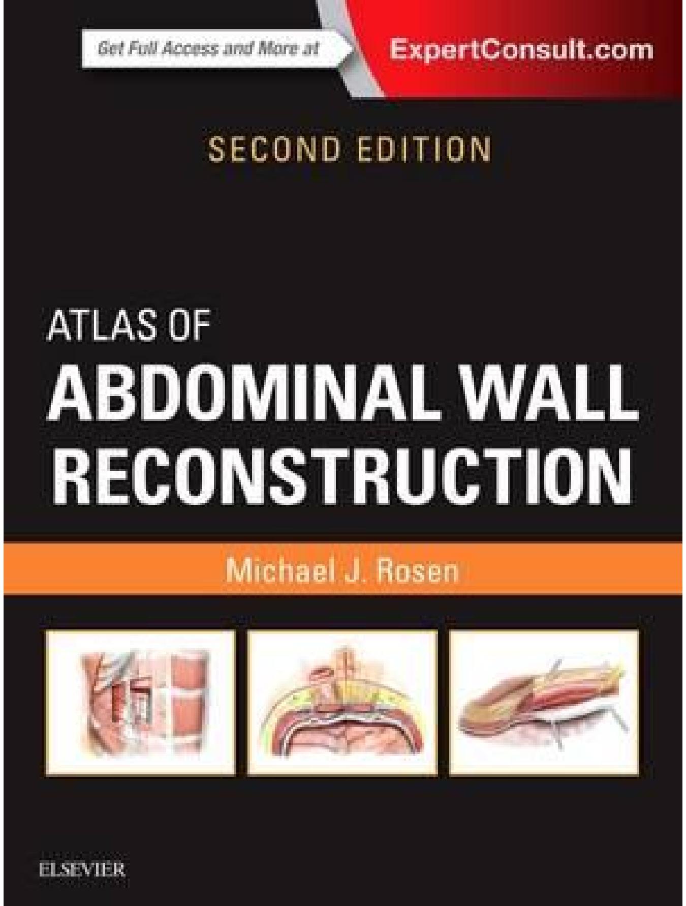Atlas of Abdominal Wall Reconstruction by Michael J. Rosen