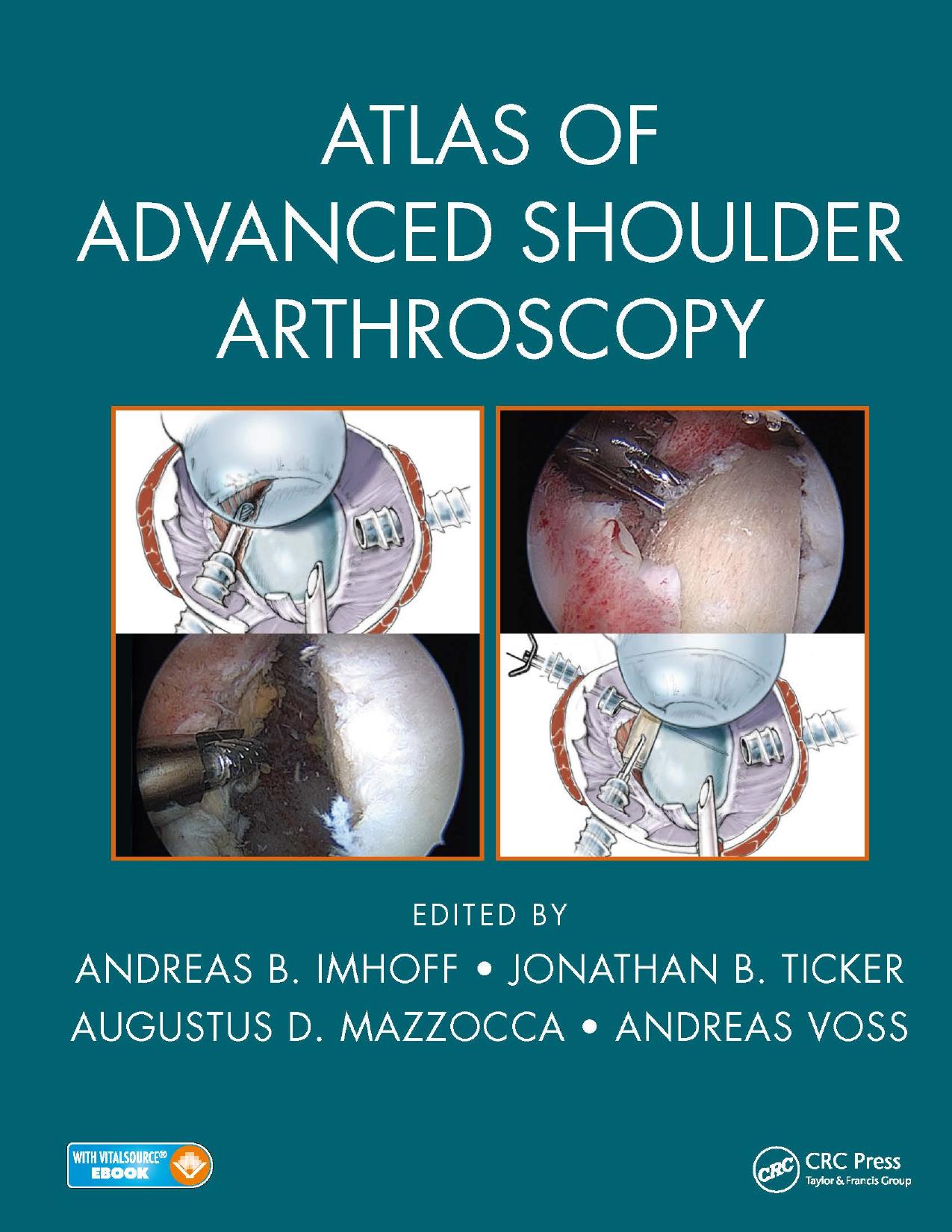 Atlas of Advanced Shoulder Arthroscopy by Andreas B. Imhoff Jonathan B. Ticker Augustus D. Mazzocca Andreas Voss