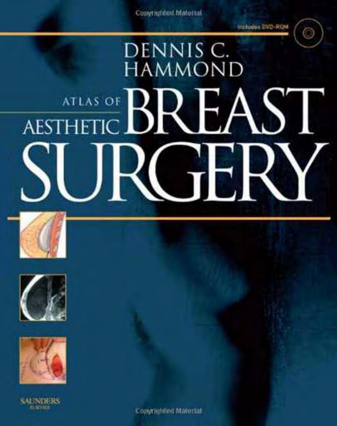 Atlas of Aesthetic Breast Surgery by 1416031847