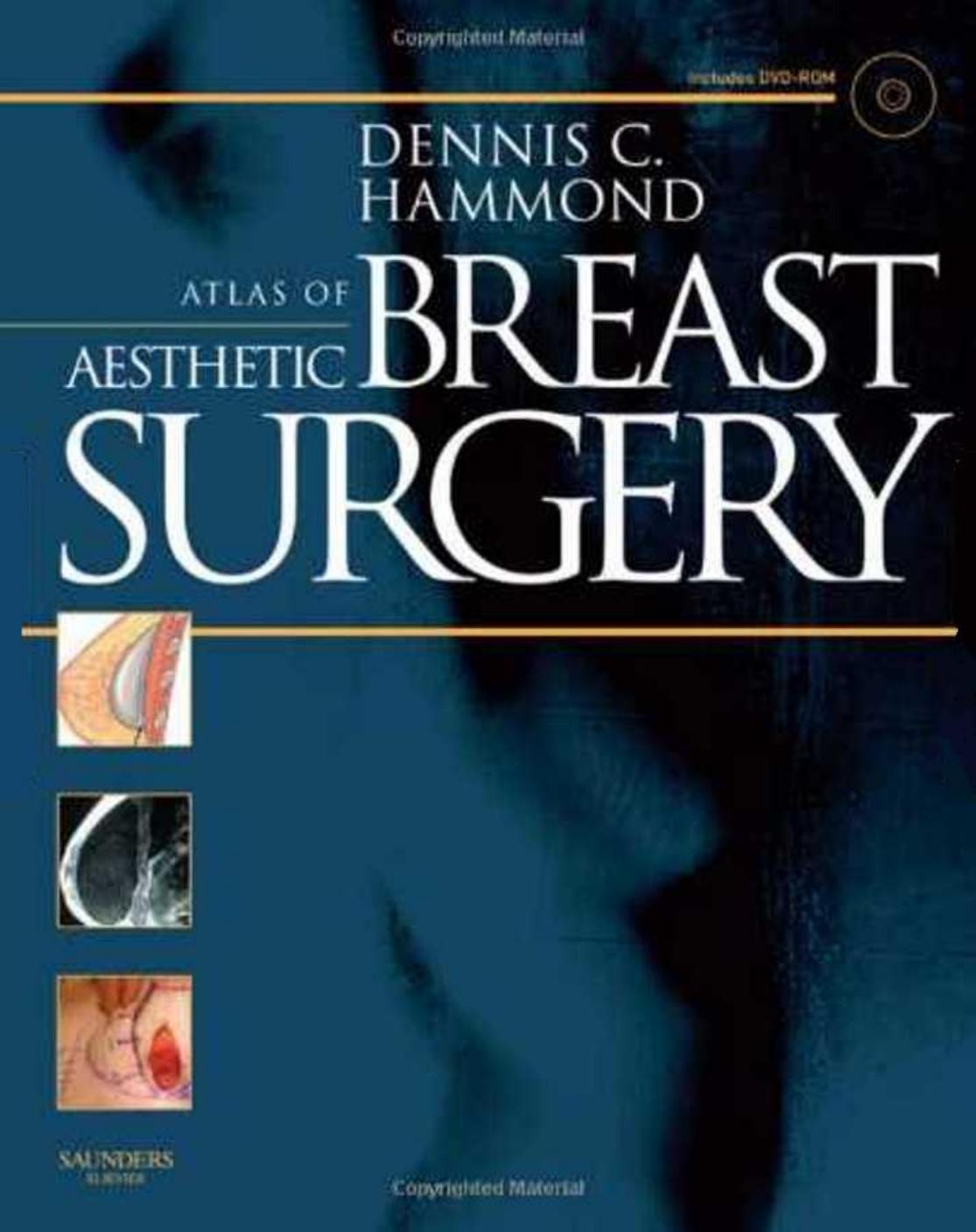 Atlas of Aesthetic Breast Surgery by Dennis C. Hammond MD